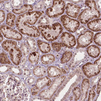 Immunohistochemical staining of human kidney shows moderate nuclear positivity in cells in proximal tubules.
