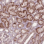 Immunohistochemical staining of human kidney shows moderate nuclear positivity in cells in proximal tubules.