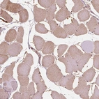 Immunohistochemical staining of human skeletal muscle shows moderate cytoplasmic positivity in myocytes.