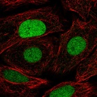 Immunofluorescent staining of human cell line SiHa shows localization to nucleus.