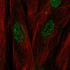 Immunofluorescent staining of human cell line BJ shows localization to nucleus.