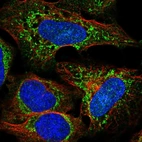 Anti-SLC25A27 Antibody