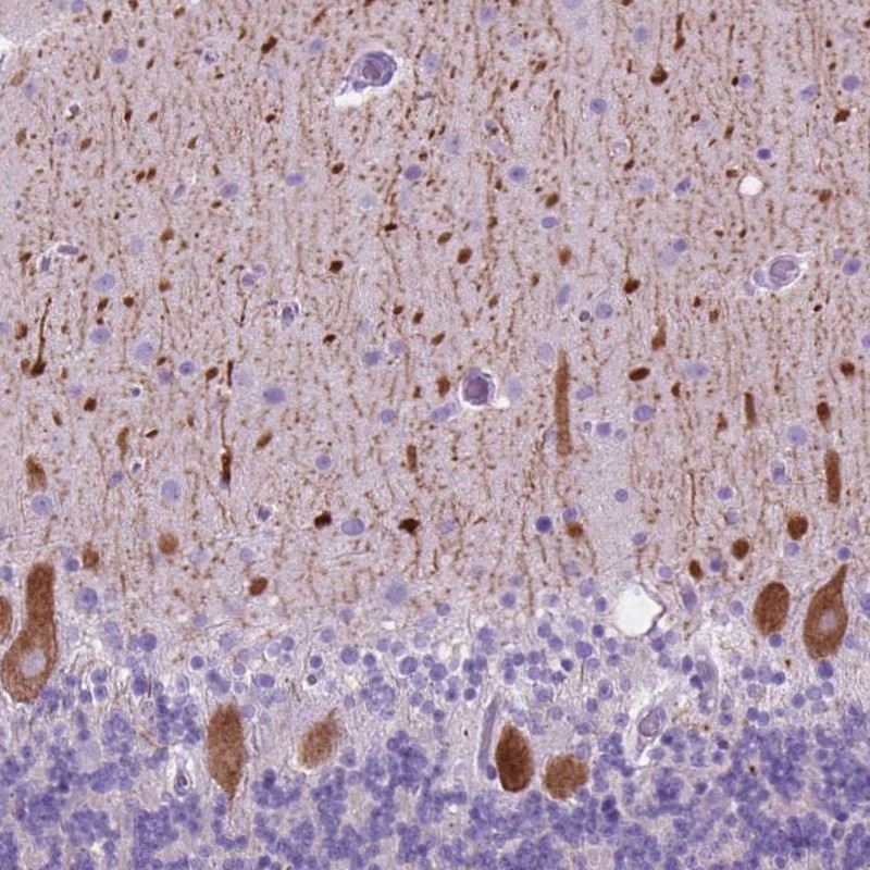 Anti-GRIN2B Antibody