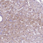 Immunohistochemical staining of human liver shows moderate cytoplasmic and nuclear positivity in hepatocytes.