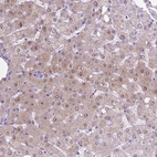 Immunohistochemical staining of human liver shows moderate cytoplasmic and nuclear positivity in hepatocytes.