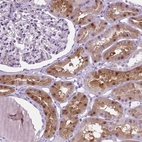 Immunohistochemical staining of human kidney shows strong cytoplasmic and nuclear positivity in cells in tubules.
