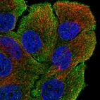 Anti-MYO5B Antibody