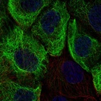 Immunofluorescent staining of human cell line A-431 shows localization to intermediate filaments.