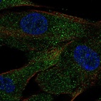 Anti-ACE Antibody