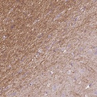 Anti-KCNIP3 Antibody