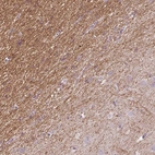 Anti-KCNIP3 Antibody