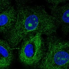 Anti-MTUS1 Antibody