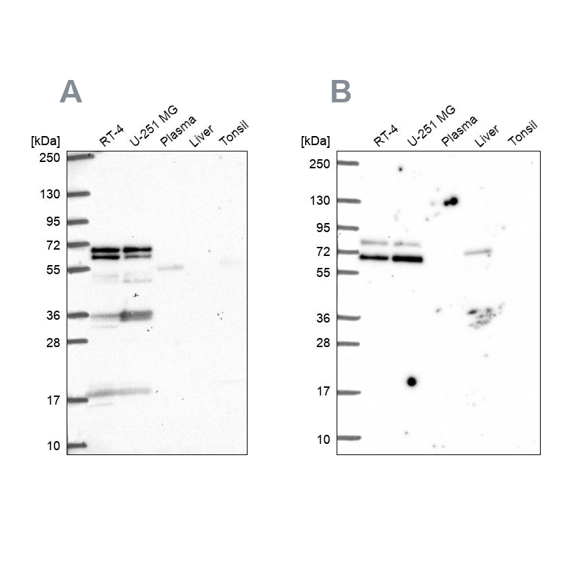 Anti-GTF3C5 Antibody