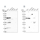 Anti-GTF3C5 Antibody