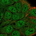 Immunofluorescent staining of human cell line RT4 shows localization to nucleoplasm & cytosol.