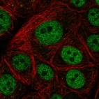 Immunofluorescent staining of human cell line MCF7 shows localization to nucleoplasm.