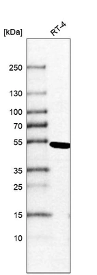 Anti-TINF2 Antibody