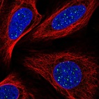 Anti-TINF2 Antibody