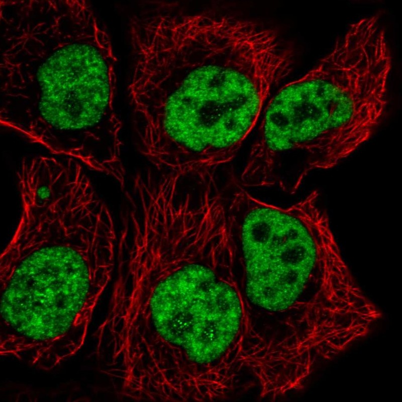 Anti-TCERG1 Antibody
