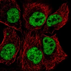 Anti-TCERG1 Antibody