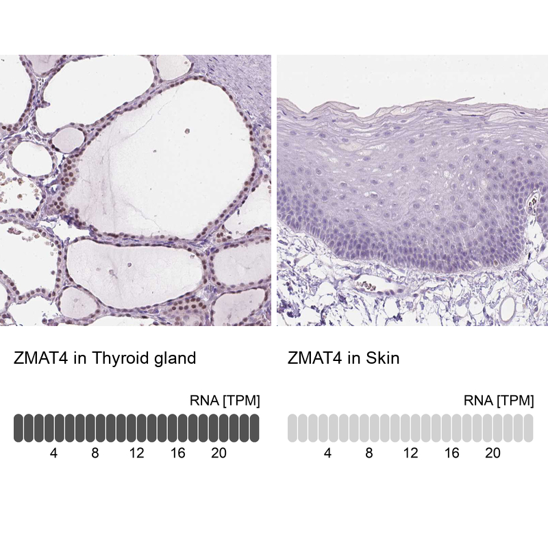 Anti-ZMAT4 Antibody