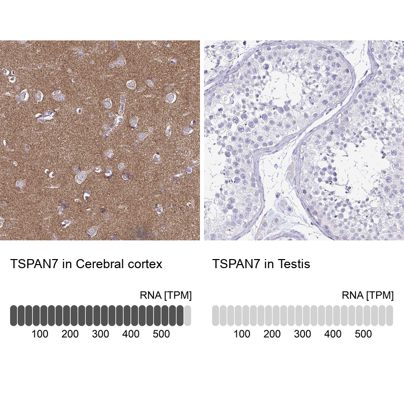 Anti-TSPAN7 Antibody