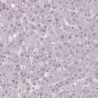 Immunohistochemical staining of human liver shows no positivity in hepatocytes as expected.