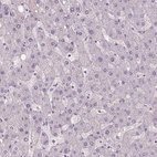 Immunohistochemical staining of human liver shows no positivity in hepatocytes as expected.