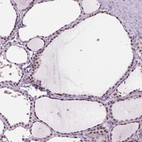 Immunohistochemical staining of human thyroid gland shows moderate nuclear positivity in glandular cells.