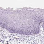 Immunohistochemical staining of human skin shows no positivity in squamous epithelial cells as expected.