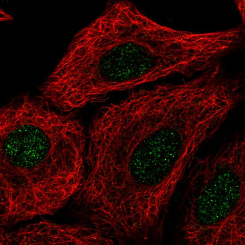 Anti-TMEM92 Antibody