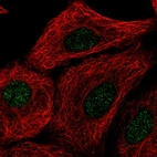 Anti-TMEM92 Antibody