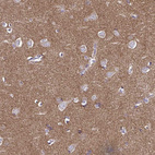 Anti-TSPAN7 Antibody