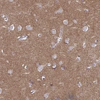 Immunohistochemical staining of human cerebral cortex shows moderate positivity in neuropil.
