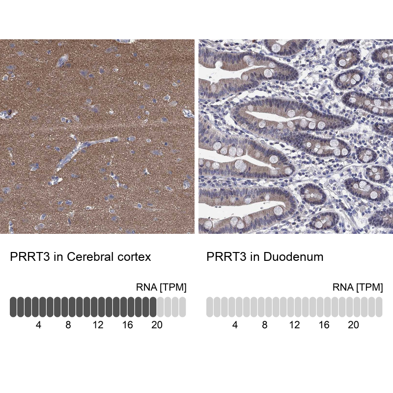 Anti-PRRT3 Antibody