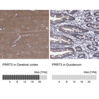 Anti-PRRT3 Antibody