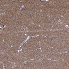 Immunohistochemical staining of human cerebral cortex shows high expression.