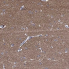 Immunohistochemical staining of human cerebral cortex shows high expression.