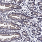 Immunohistochemical staining of human duodenum shows low expression as expected.
