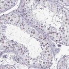 Immunohistochemical staining of human testis shows strong positivity in nuclear speckles in cells in seminiferous ducts.