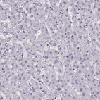 Immunohistochemical staining of human liver shows no positivity in hepatocytes as expected.
