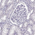 Immunohistochemical staining of human kidney shows no positivity in cells in tubules as expected.