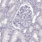 Immunohistochemical staining of human kidney shows no positivity in cells in tubules as expected.