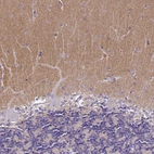 Immunohistochemical staining of human cerebellum shows moderate positivity in neuropil.