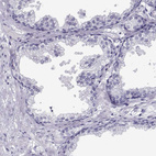 Immunohistochemical staining of human prostate shows no positivity in glandular cells as expected.