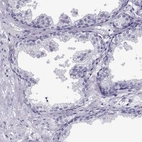 Immunohistochemical staining of human prostate shows no positivity in glandular cells as expected.