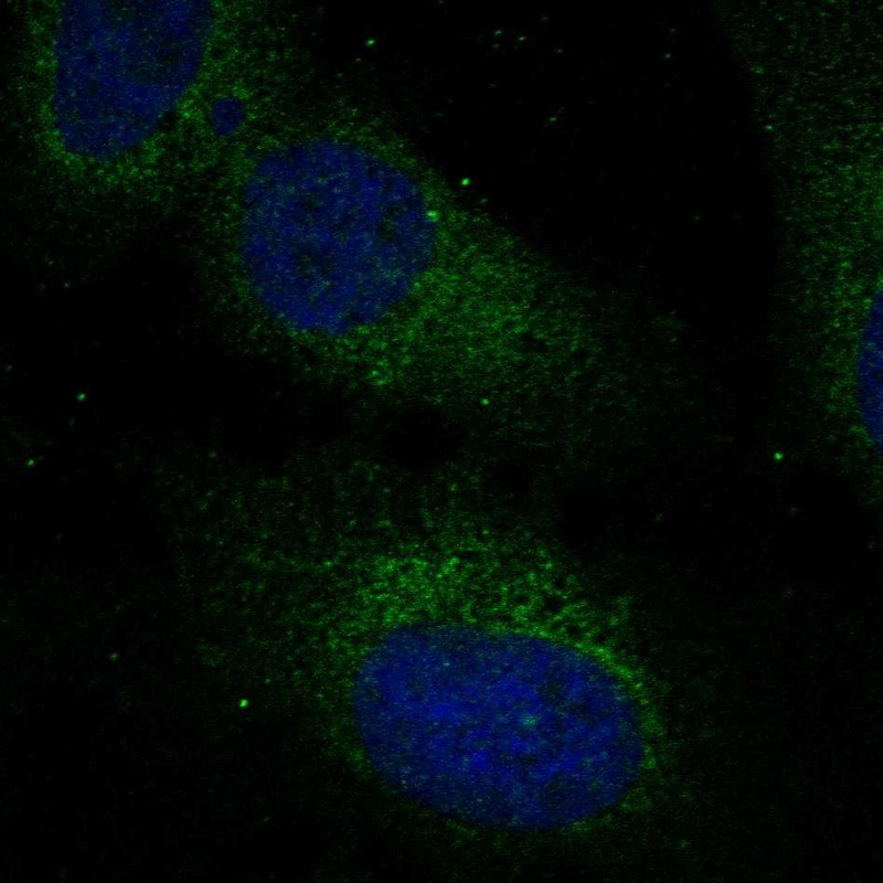 Anti-RABL3 Antibody
