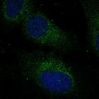Anti-RABL3 Antibody