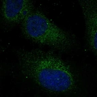 Anti-RABL3 Antibody