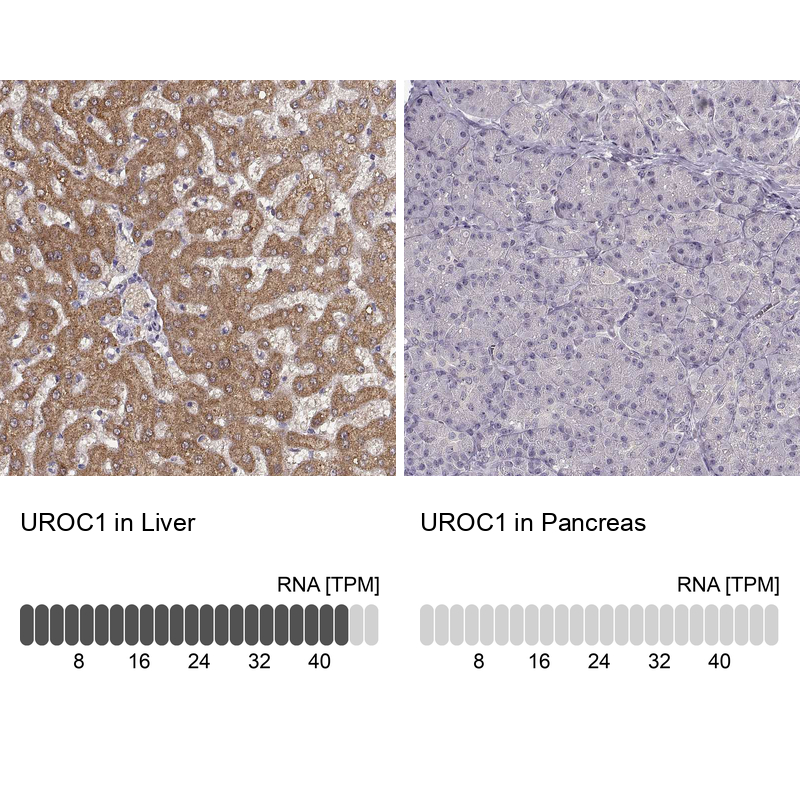 Anti-UROC1 Antibody
